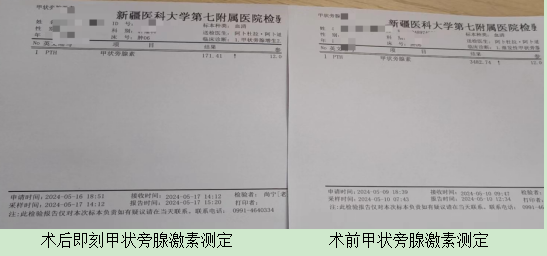 肾衰患者甲状旁腺亢进，多学科联合解除“刻骨”之痛